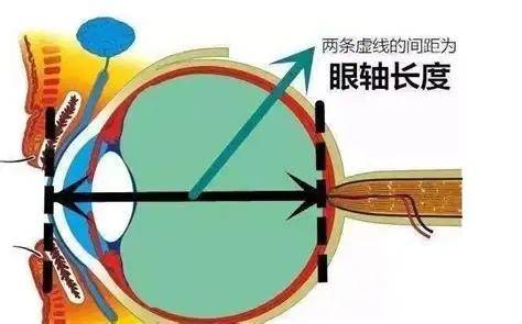 怎么看电视不伤眼？甚至还能延缓孩子近视？